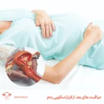 مراقبتهای بعد از لاپاراسکوپی رحم