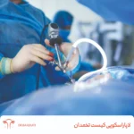 لاپاراسکوپی کیست تخمدان